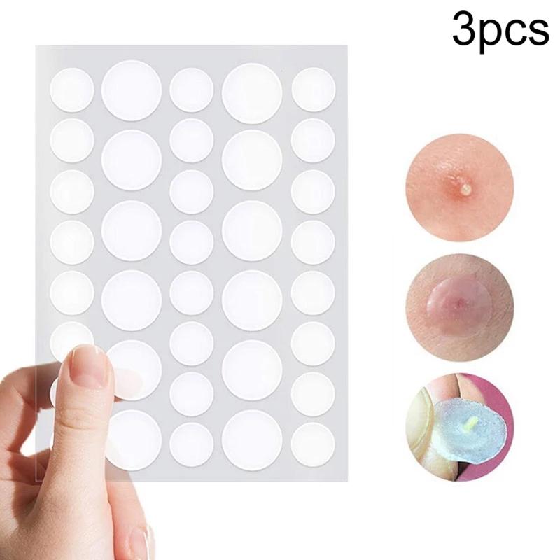 3-Piece Acne Treatment Set For Scars And Pimples-1915197382761517056