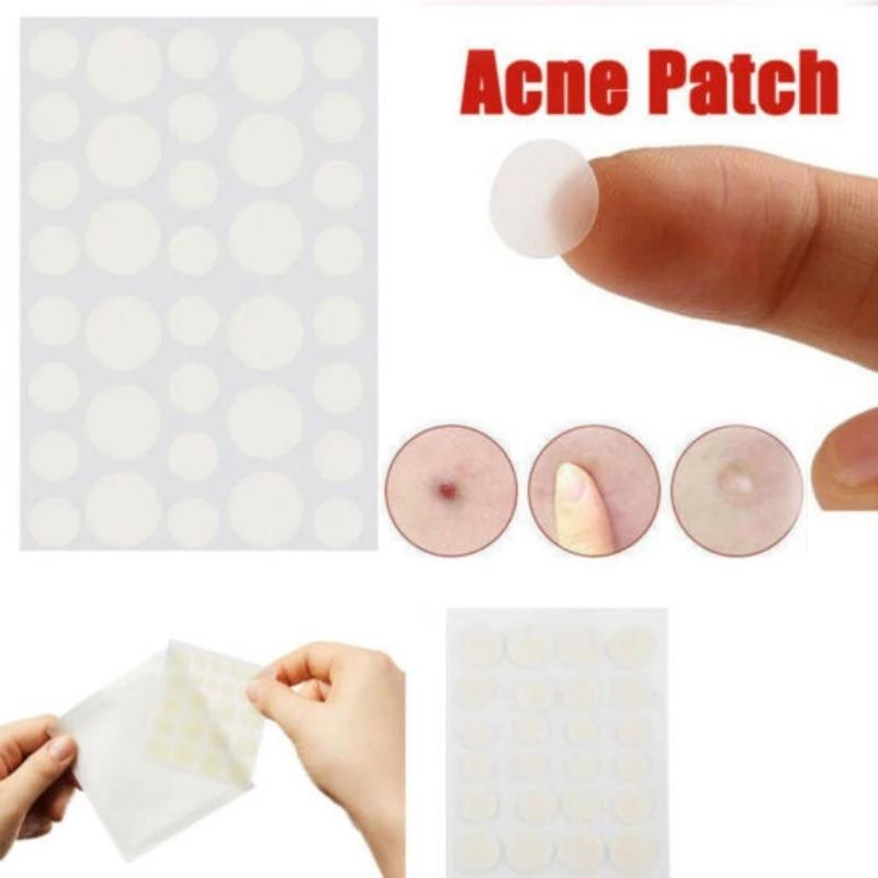 3-Piece Acne Treatment Set For Scars And Pimples-1915197382761517063